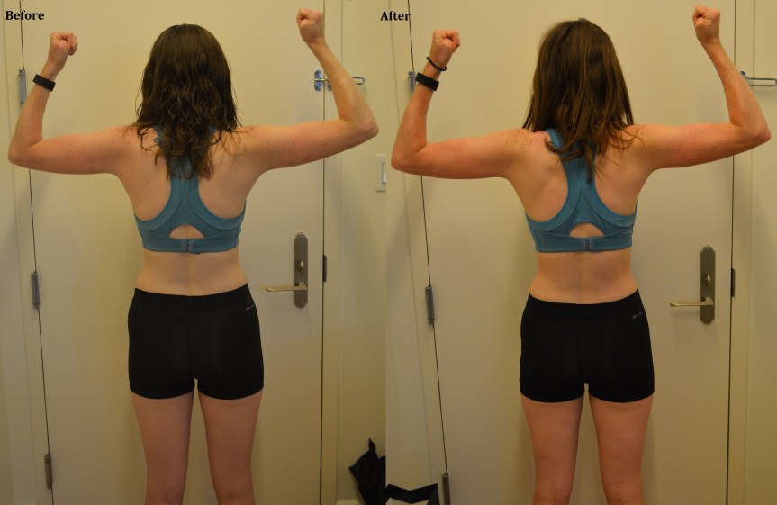 Back - Before & After